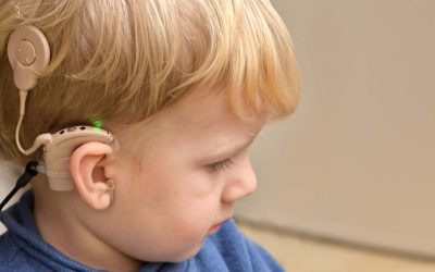 En que casos están indicados los implantes cocleares